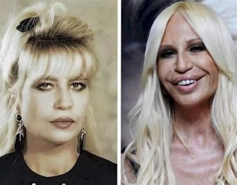 donatella versace guerra|what happened to donatella versace's face.